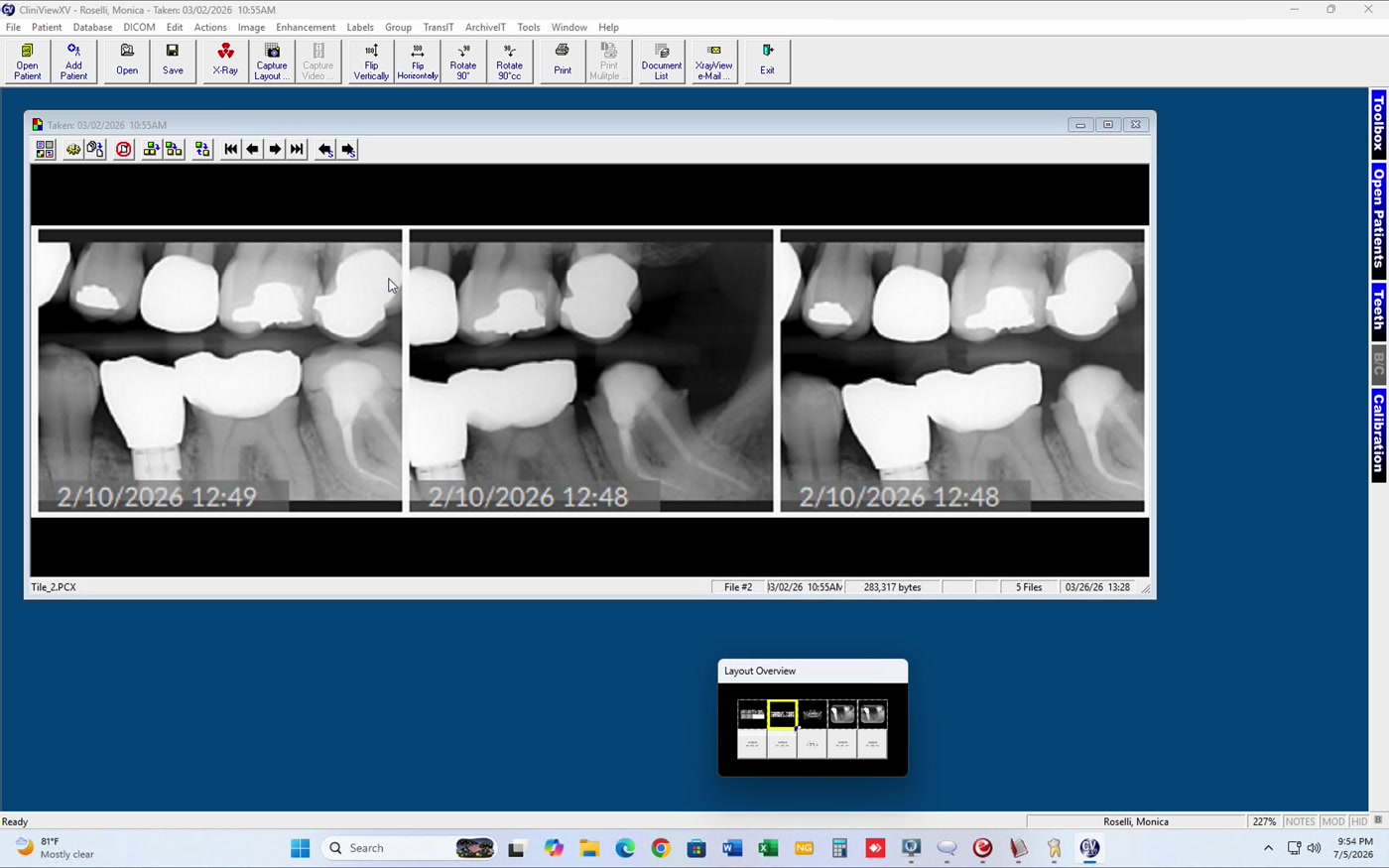 X-ray series with Layout Overview