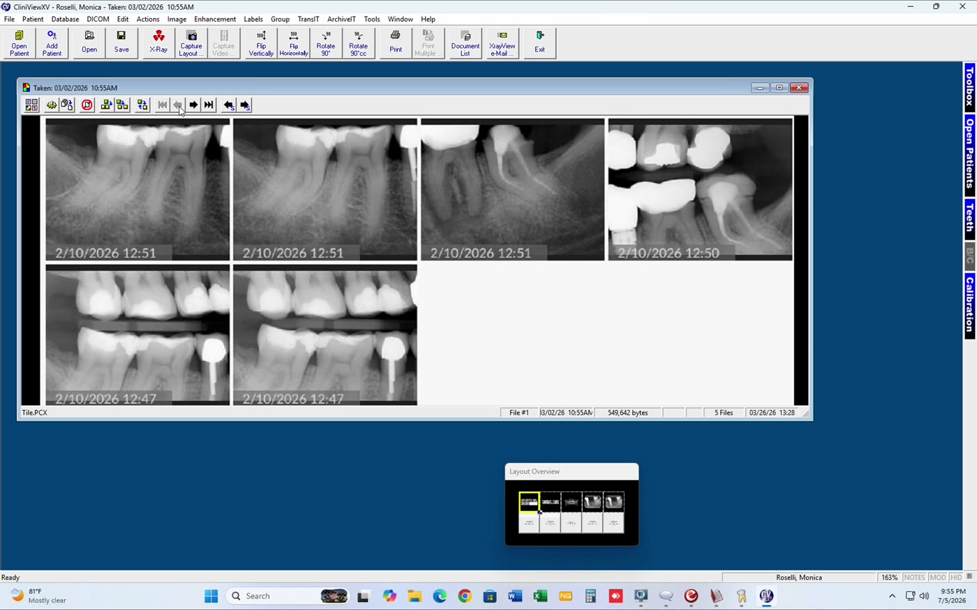 Another X-ray series
